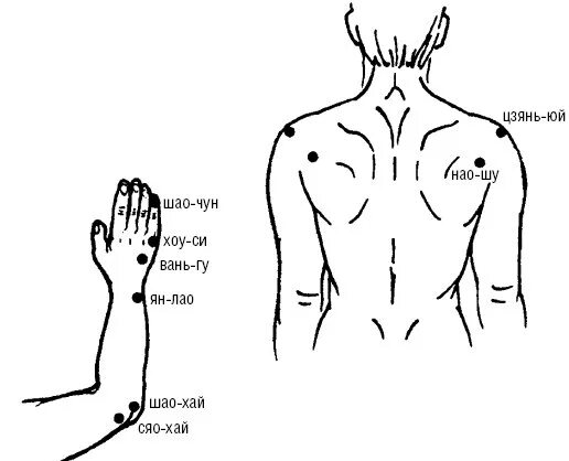 Точечный массаж при невропатии локтевого нерва. Нейропатия локтевого нерва точки акупунктуры. Точечный массаж при неврите локтевого нерва. Акупунктура при неврите локтевого нерва точки.