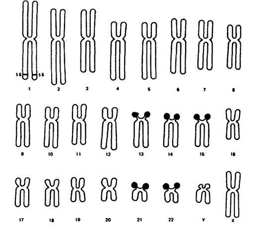 Схема хромосомного набора. 46 Хромосом у человека. Хромосомный набор человека. Набор человеческих хромосом. Генетический набор хромосом человека.