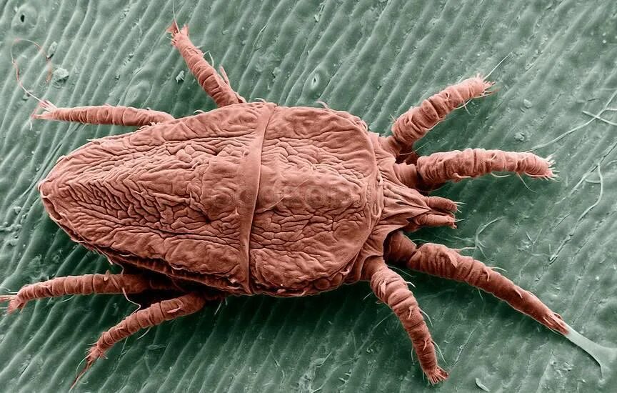 Чесоточный клещ под микроскопом. Дерматофагоидес фарина. Куриный клещ (dermanyssus gallinae). Домашний клещ –dermatophagoides pteronyssinus. Клещи перьевые человека.