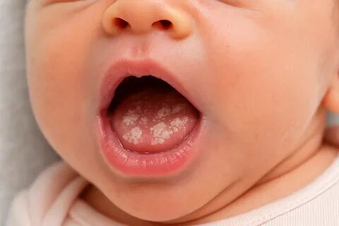 Chokkalab otirgan semiz ayollarning fotosuratlari