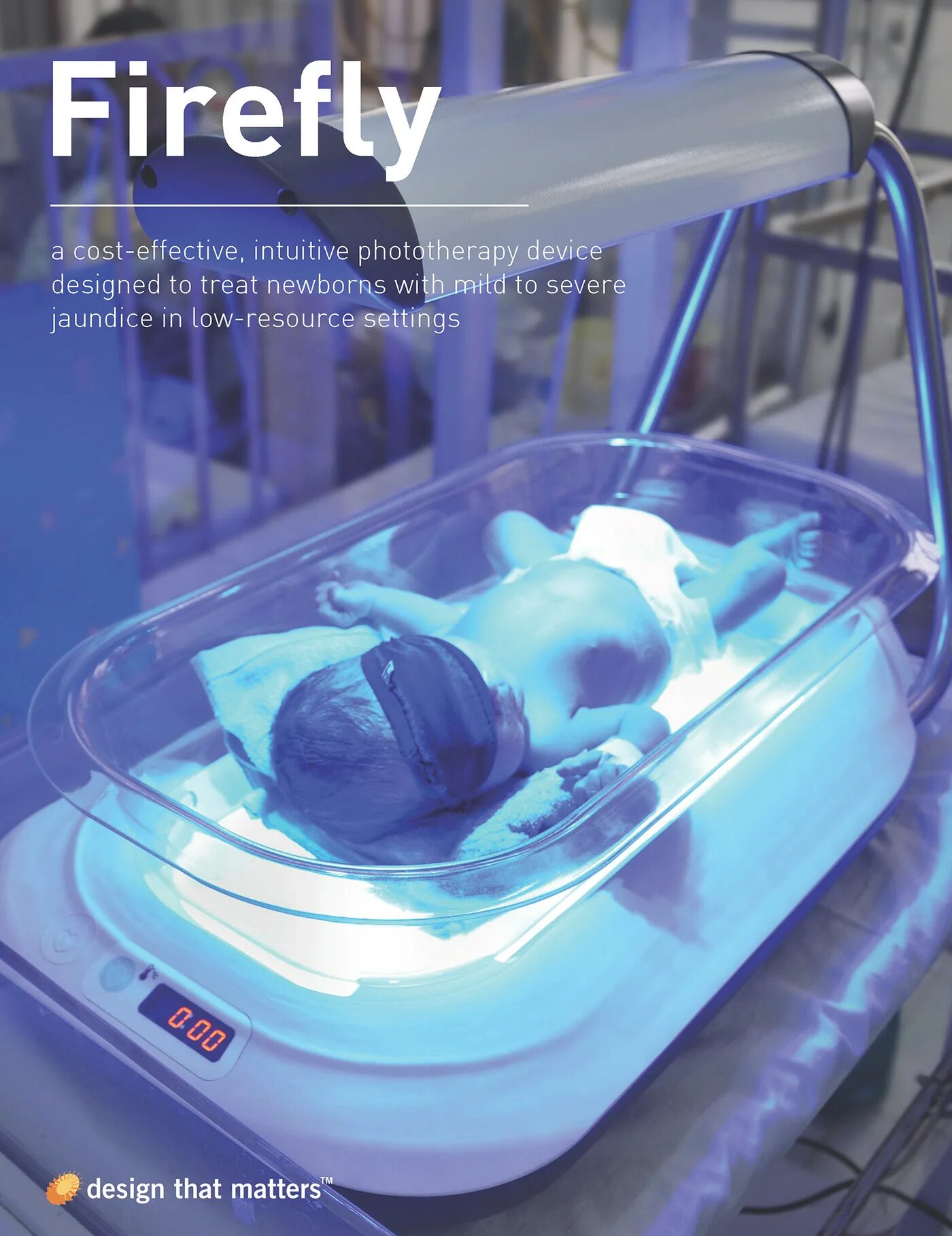 Синяя лампа для новорожденных от желтушки. Фототерапия для новорожденных при ГБН. Желтушка у новорожденных фототерапия. Лампа для фототерапии новорожденных.