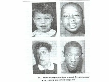 Человек с 1 хромосомой