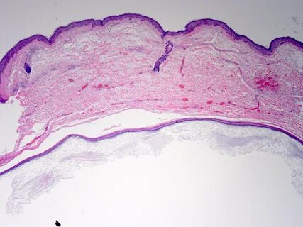Pathology outlines