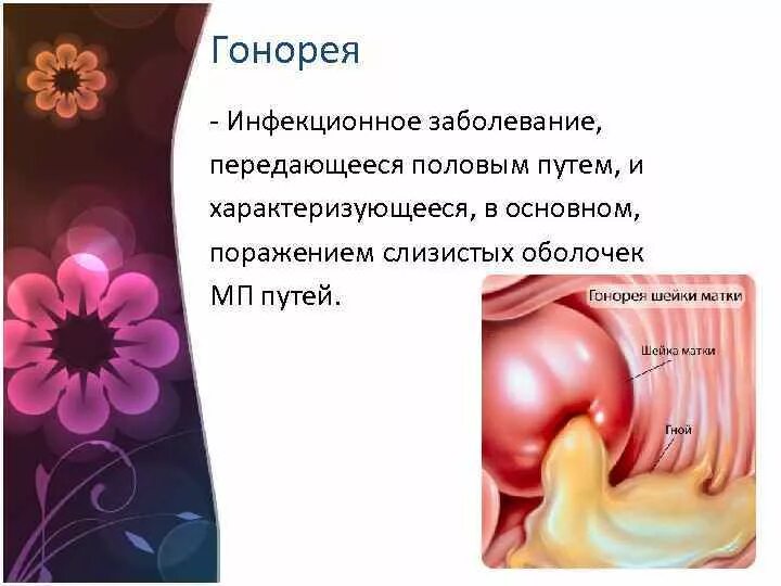 Зппп у девушек. Зппп у девушек
