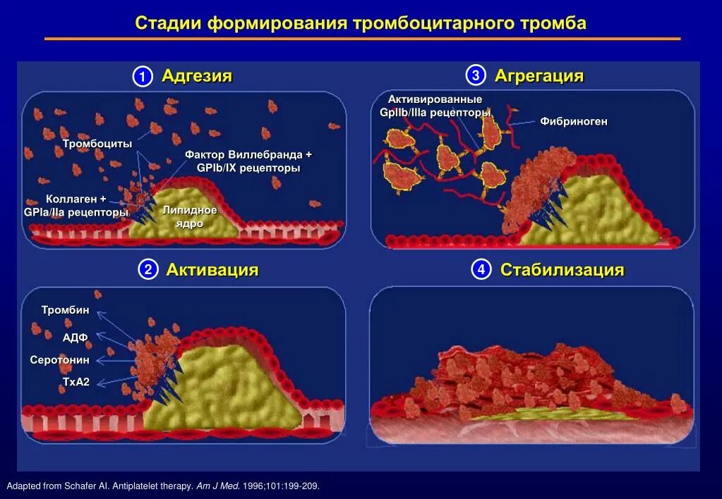 Этапы образования тромба схема. Стадии формирования тромба. Стадии образования тромба. Этапы образования тромбоза. Образование тромба попадание факторов свертывания в плазме