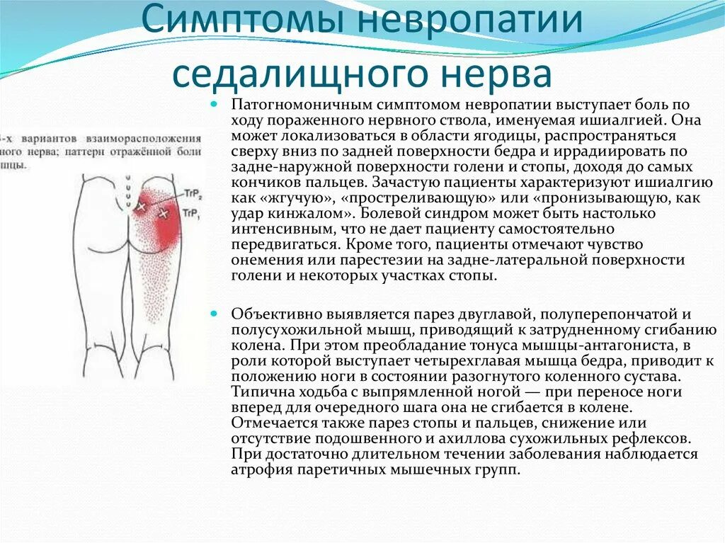 Воспаление седалищного нерва симптомы у мужчин. Поражение седалищного нерва симптомы. Воспаление седалищного нерва симптомы. Седалищный нерв симптомы и причины. Нейропатия седалищного нерва.