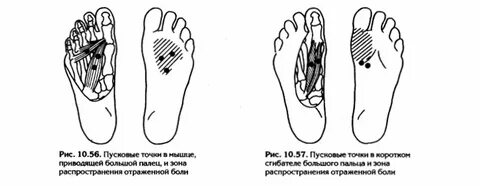 Болят пальцы на ногах и руках причины
