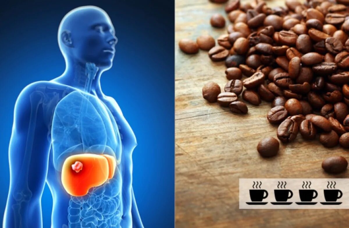 Кофе и печень как влияет. Кофе влияет на печень. Влияние кофе на организм человека. Кофе воздействие на печень. Кофеин в организме человека.
