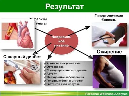 Диабет инфаркт