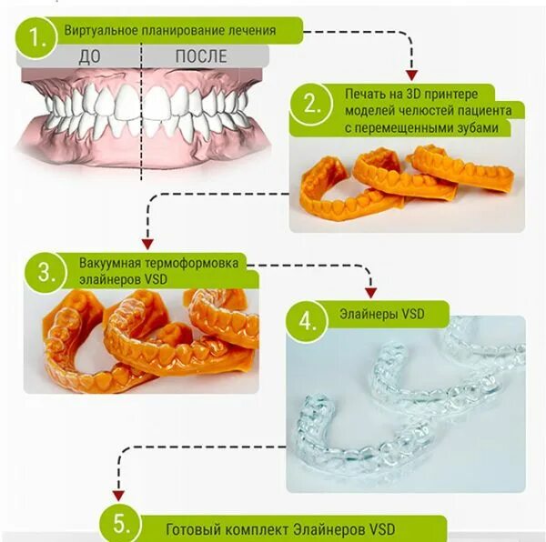 можно ли пить в элайнерах