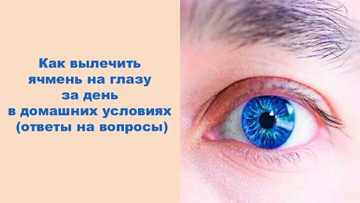 Как быстро убрать ячмень с глаза: найдено 87 изображений