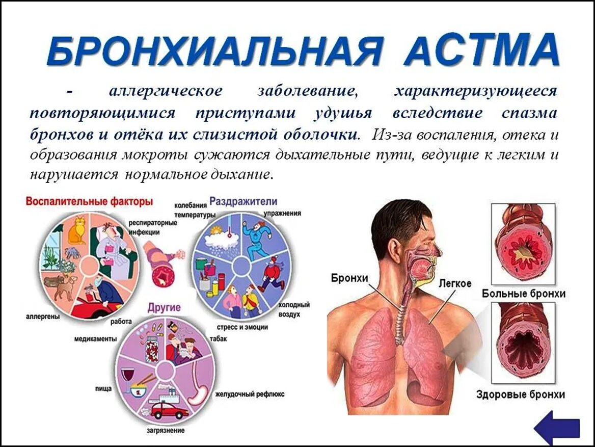 Лечение легкой астмы. Заболевания органов дыхания бронхиальная астма. Бронхиальная астма это заболевание. Бронхи при бронхиальной астме.