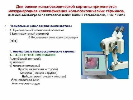 Кольпоскопия тип 1