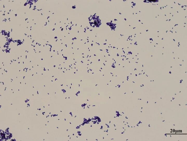 Corynebacterium spp в мазке у мужчин. Коринебактерии микроскопия. коринебактерии дифтерии микробиология. коринебактерии по граму. corynebacterium diphtheriae по граму.