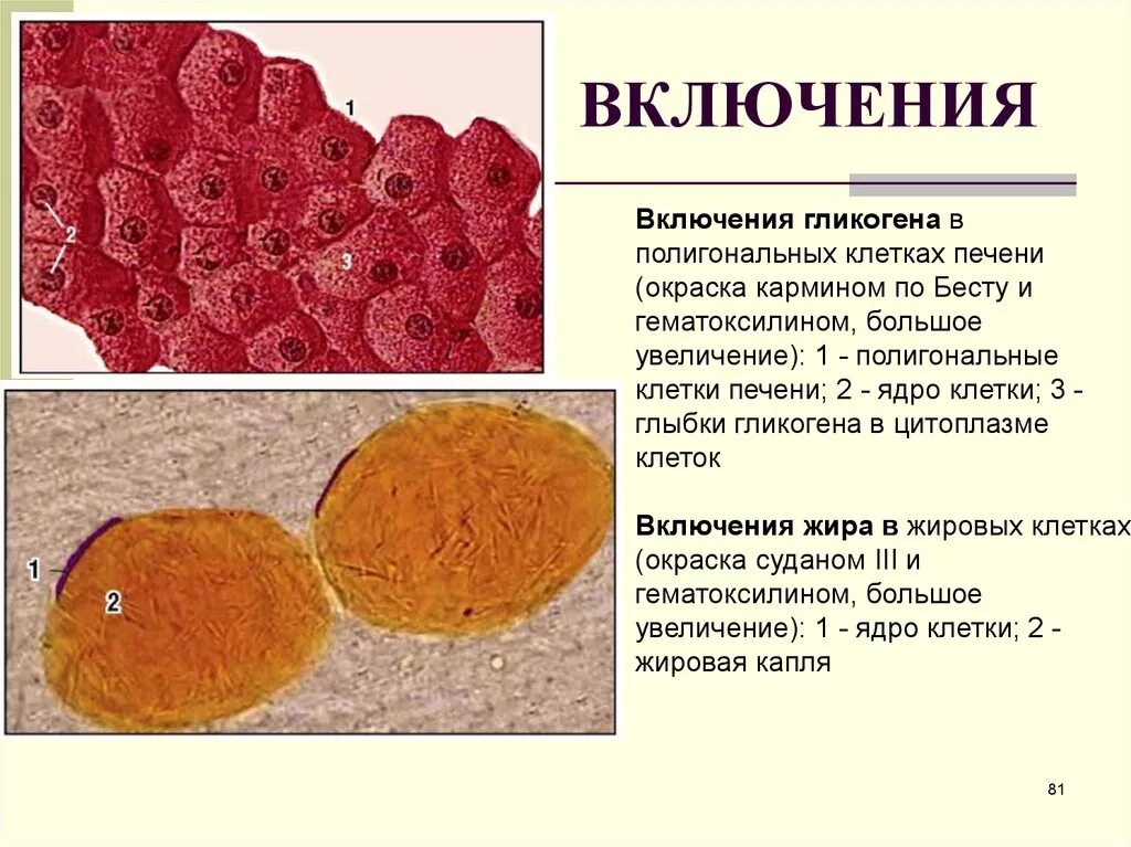 Жировые включения препарат гистология. Включения гликогена в клетках печени свиньи. Окраска кармином по Бесту гистология. Включения жира в клетках печени амфибии.