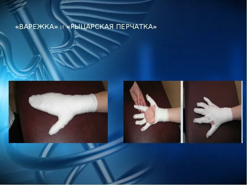 Техника наложения варежки. Наложение повязки Рыцарская перчатка. Рыцарская перчатка десмургия. Десмургия повязка перчатка. Рыцарская перчатка повязка.