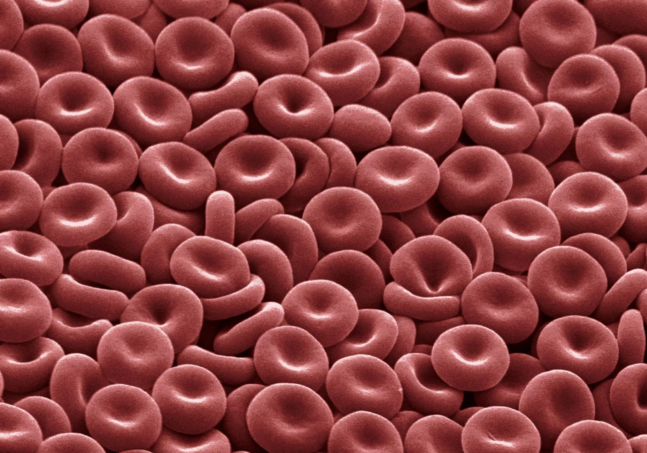 Выработка эритроцитов. Красные кровяные тельца эритроциты. Blood Cells эритроциты. Клетки крови гемоглобин. Кровь под микроскопом.
