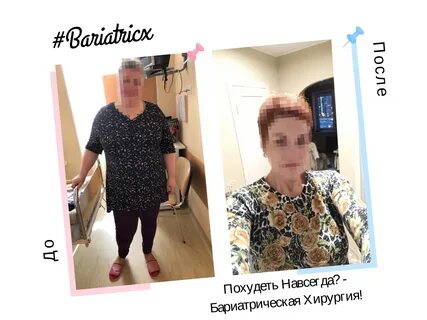 Бариатрическая операция омск