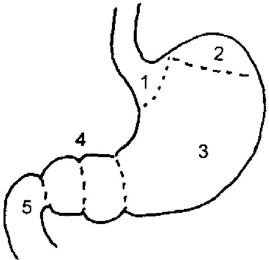 4 части желудка. Желудок анатомия строение рисунок. Антральный отдел желудка схема. Схема анатомических отделов желудка. Строение желудка схематично.