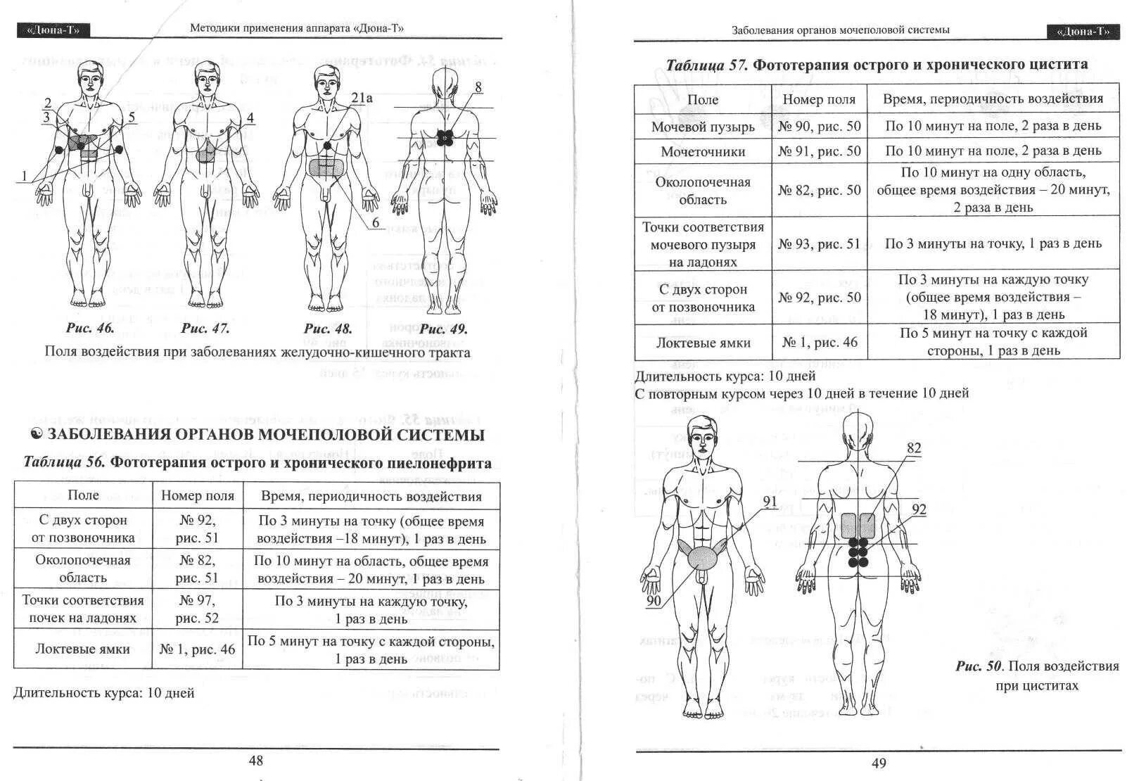 Витафон инструкция отзывы. Фототерапевтический аппарат Дюна-т инструкция. Схема точек воздействия витафоном. Дюна-м аппарат фототерапии инструкция. Витафон ИК схема точек.