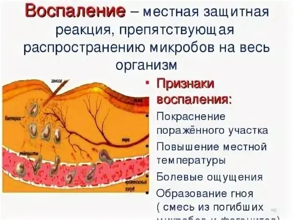 Воспалительный процесс. Нейровоспалительный процесс. Воспалительная реакция.