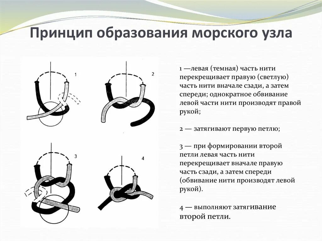 Почему образуются узлы. Морской узел в хирургии техника. Простой хирургический узел схема. Виды хирургических узлов. Женский хирургический узел.