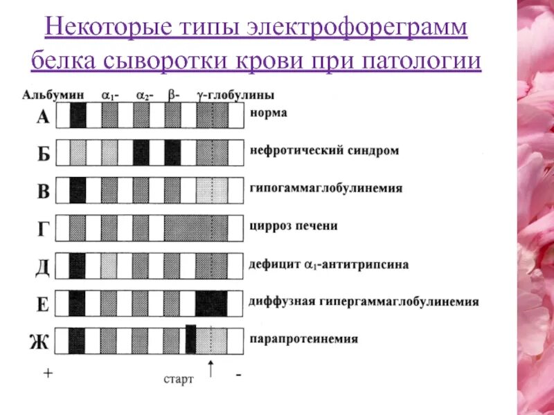 Характерные изменения белков. Электрофореграмма белков сыворотки крови. Электрофорез белков сыворотки норма. Типы электрофореграмм белков. Электрофорегремма белков сыврортка крови.