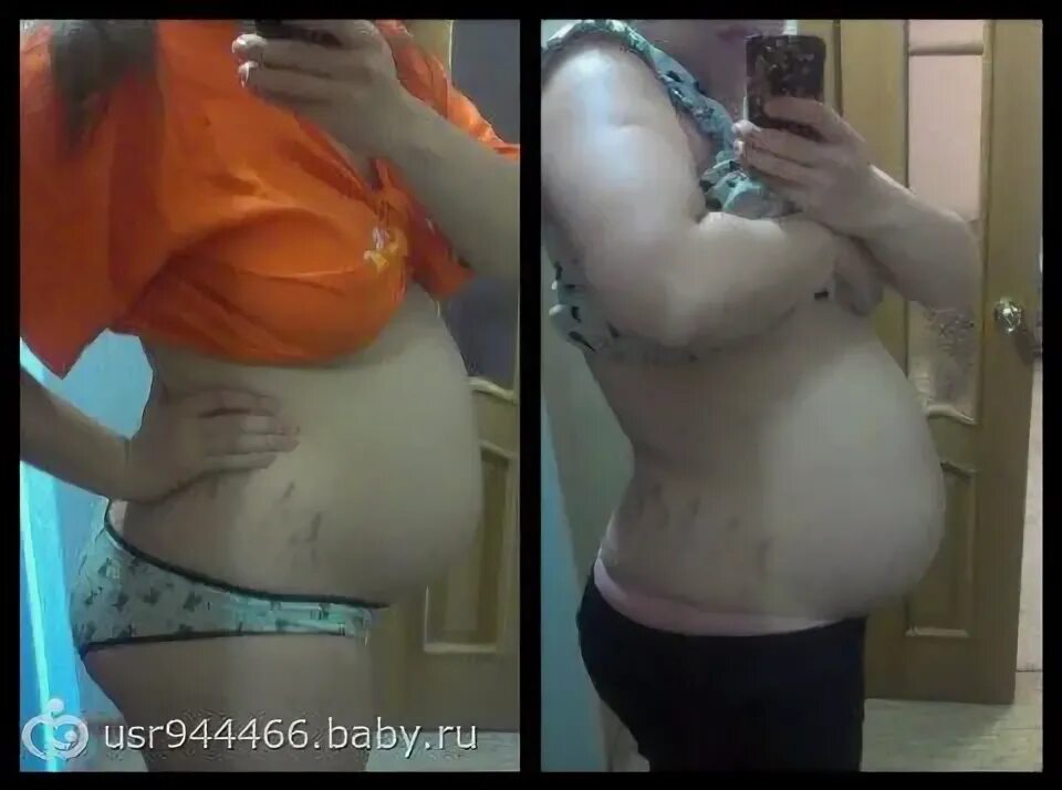 Живот до и после опущения. Опущение живота фото до и после. Как выглядит опустившийся живот у беременных. Опустился живот фото до и после.