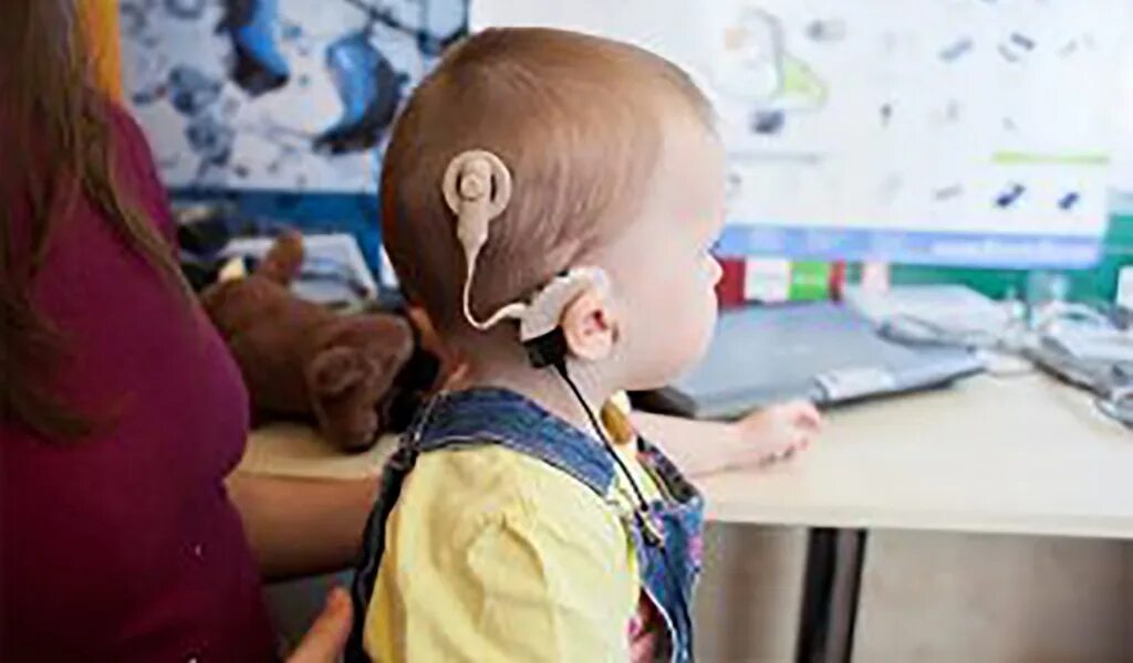 Кохлеарная имплантация Cochlear. Кохлеарный имплант Кохлер. Глухие и слабослышащие дети. Дети с нарушением слуха..