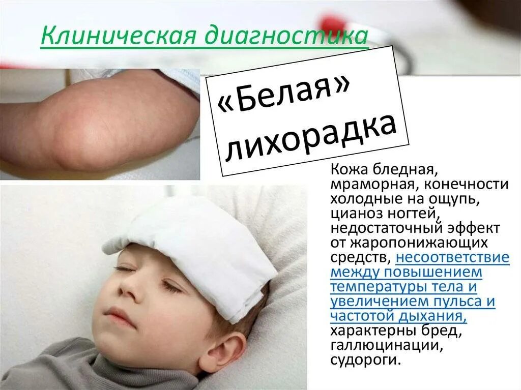 Больной ребенок. Бледная гипертермия. Повышенная температура. Простуда. Простуда.