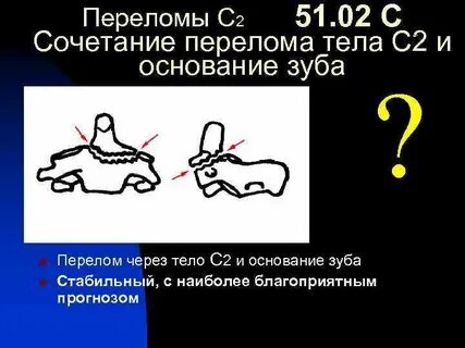 Сочетанный перелом