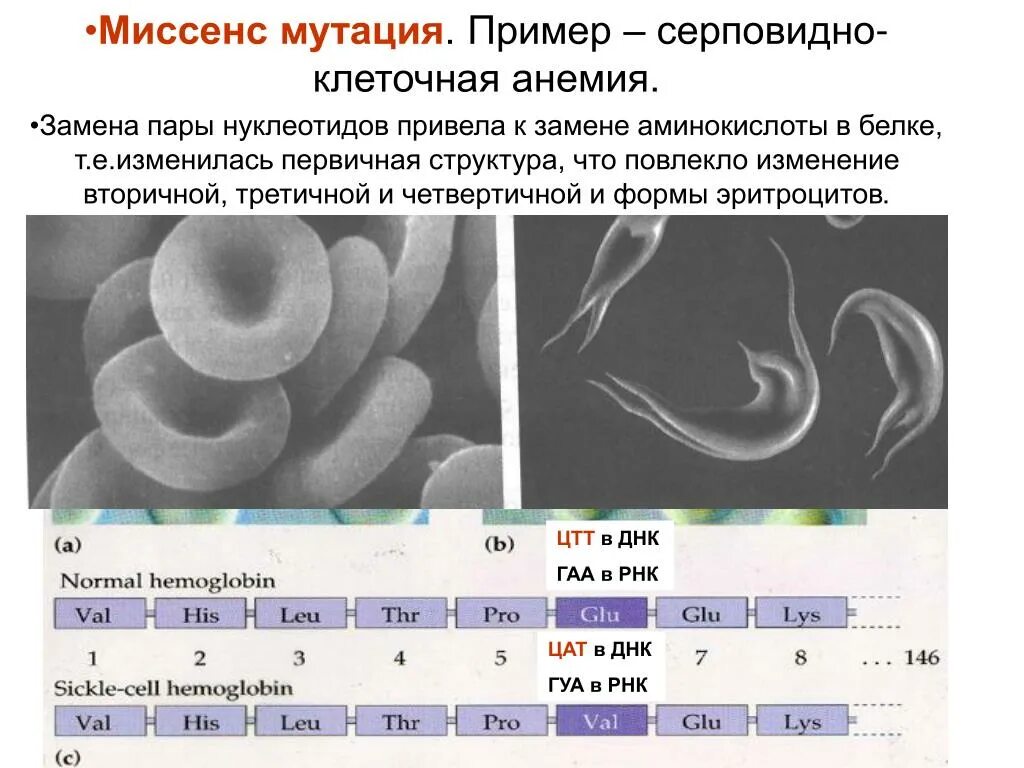 Замена нуклеотидов тип мутации. Миссенс мутация примеры. серповидноклеточная анемия генная мутация. серповидноклеточная анемия тип мутации. серповидно-клеточная анемия человека.