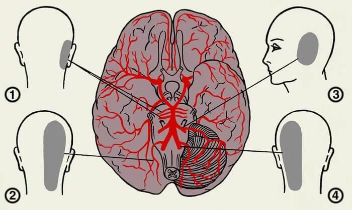 Почему дает в голову. Левая затылочная часть головы. Болит голова в затылочной части. Боль в голове с левой стороны в затылочной части.