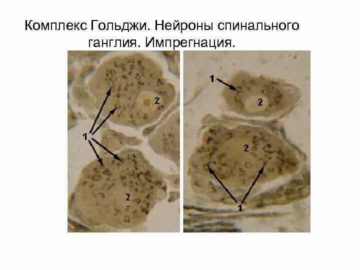 Аппарат Гольджи в нейронах спинального ганглия. Комплекс Гольджи в нервных клетках спинномозгового узла. Препарат комплекс Гольджи в нервных клетках спинального ганглия. Комплекс Гольджи в нейронах спинального ганглия кошки. Пластинчатый комплекс