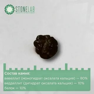 Через какое время выйдет камень