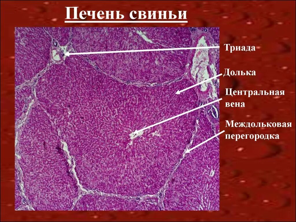 Триада печени. Печень человека гистология препарат. Ацинус печени гистология. Печень свиньи гистологический препарат. Центральная Вена печени гистология.