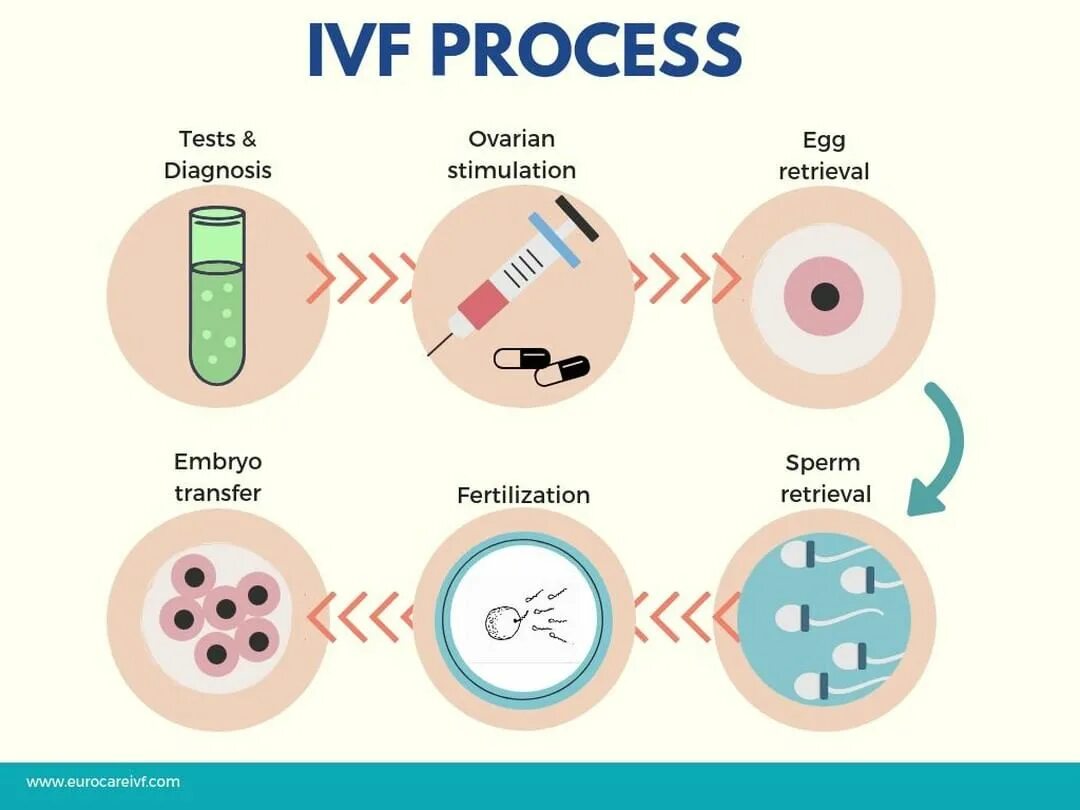 Proceso de la fecundacion in vitro