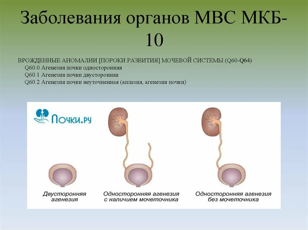 Аномалии развития мочеполовой. Врождённая аномалия развитие органов мочевыводящей системы что это. Врожденные аномалии развития мочевыделительной системы у детей. Пороки развития мочевой системы. Мочевая система.