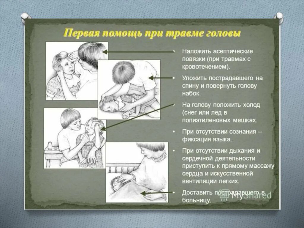 Уложили голову набок. Оказание помощи при травме головы. Оказание неотложной помощи при травмах головы. Неотложная помощь при травме головы. Оказание первой мед помощи при травме головы.