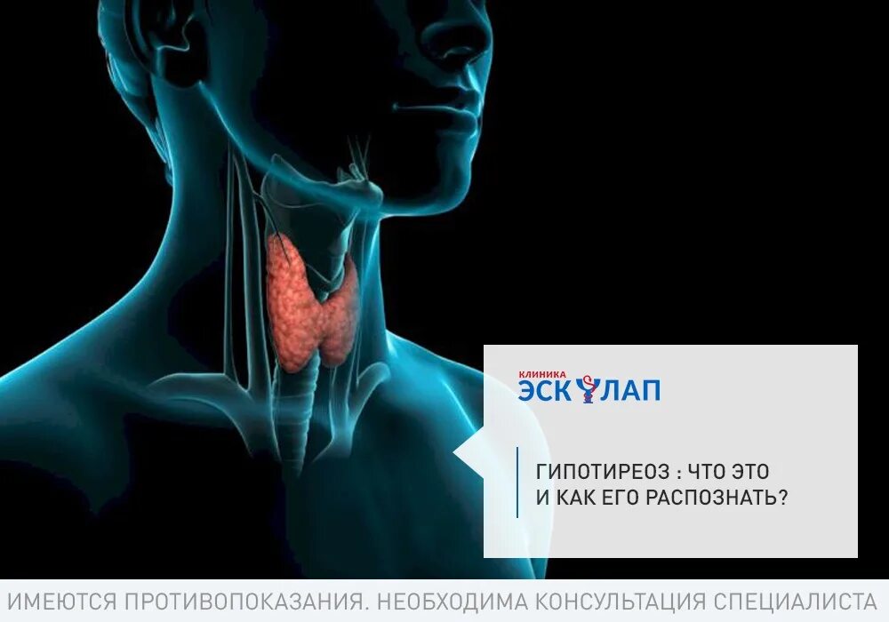 Заболевание щитовидной железы гипотиреоз. Хаит щитовидной железы симптомы.