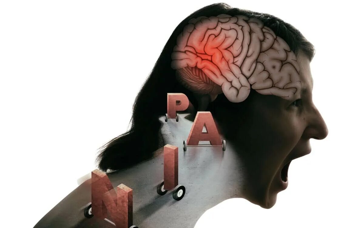 Dravet syndrome. Заболеваний нервной системы и головного мозга. Головной мозг хронический стресс. Living head. Пикассо мигрень.