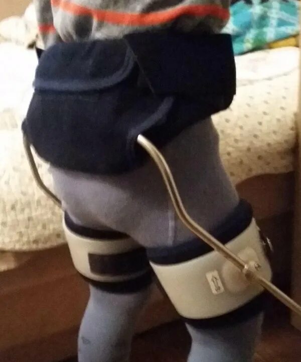 свош аппарат на тазобедренный сустав. аппарат свош. ортез свош. аппарат свош дцп. ортез свош.