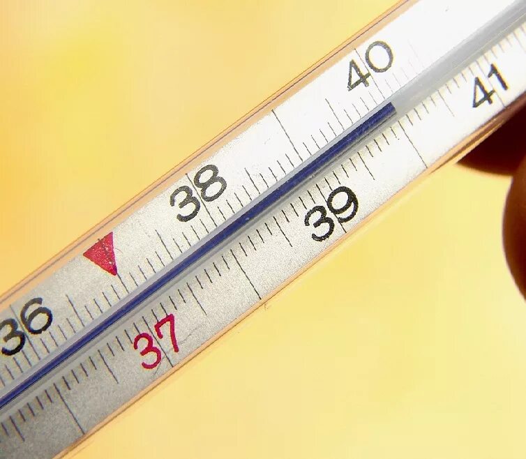 Картина крови при сепсисе. Лихорадка это простыми словами. Астраханская риккетсиозная лихорадка симптомы. Температура виды температуры. Причины петехиальной сыпи.