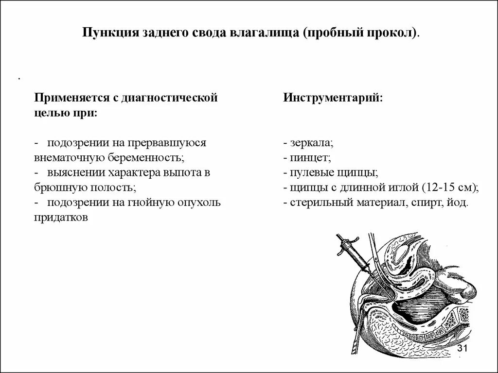 Набор инструментов для проведения пункции заднего свода. Пункция заднего свода инструментарий. Набор инструментов для пункции брюшной полости через задний свод. Пункция заднего свода брюшной полости. Задний свод матки