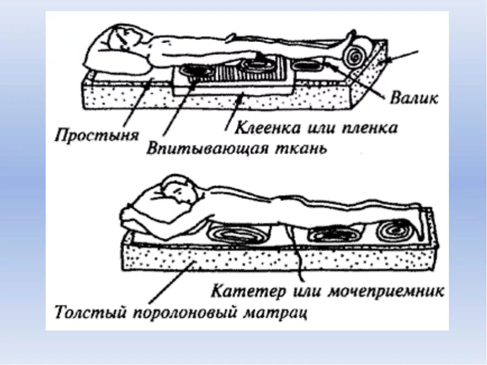 Чем обрабатывать пролежни у лежачих