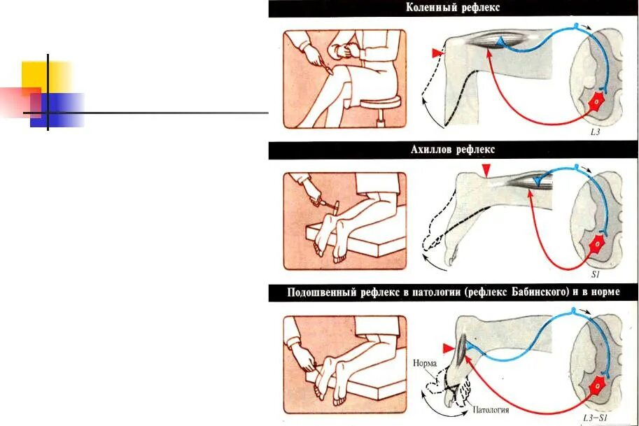 Как подавить рефлекс. Коленный и Ахиллов рефлексы физиология. Ахиллов рефлекс рефлекторная дуга. Коленный рефлекс Ахиллов рефлекс. Ахиллов рефлекс физиология схема.