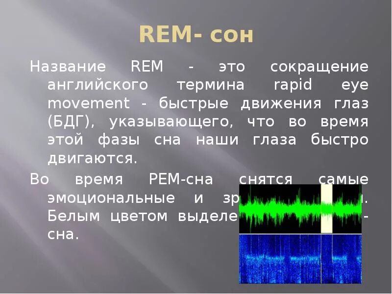 Песня с названием сон. Rapid Eye Movement. Rem фаза сна. БДГ фаза. Быстрое движение глаз во время сна.