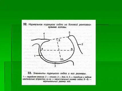 Передне задний диаметр