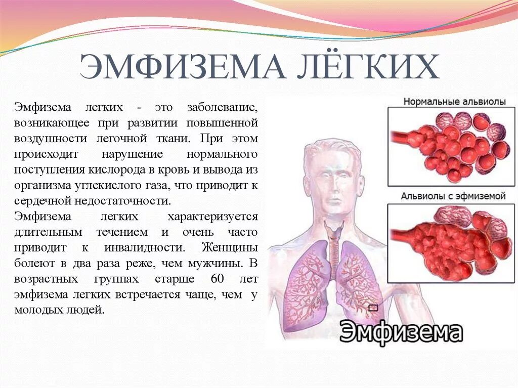 Заболевание легких эмфизема. Причина развития эмфиземы. Что значит легкие расширены