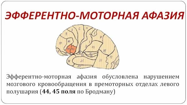 Центр афазии